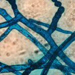Fungi_-_Hyphae_-_(lactophenol_cotton_blue_dye) (1)