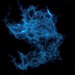 Fungi_seen_with_fluorescence_microscope