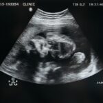 pexels-pavel-danilyuk-7108416