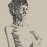 Miss_K._R-_aged_14,_before_treatment_for_anorexia_Wellcome_L0073694_(cropped)